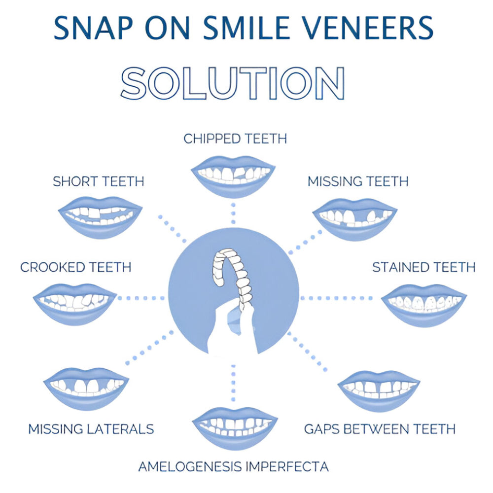 Set di faccette dentali cosmetiche per miglioramento del sorriso