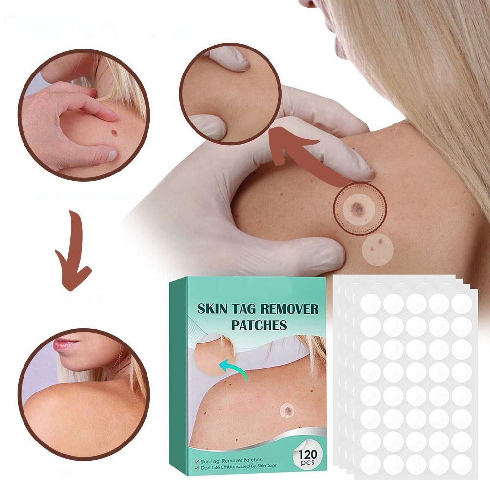 Skin Tag Remover Hydrocolloid Patches - Image 8